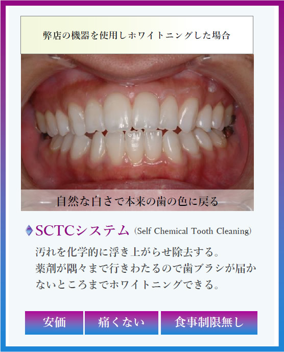 kirariセルフホワイトニングルーム|無人セルフ脱毛・エステ